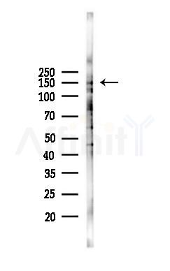 Myelodysplasia Syndrome 1 Antibody - Western blot analysis of lysates from COLO205 cells(heat-shock,45min treatment), using Myelodysplasia Syndrome 1 Antibody at 1/1000 dilution.