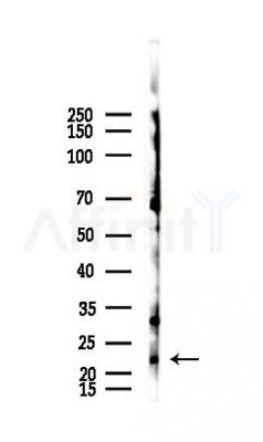 CBF beta Antibody - Western blot analysis of lysates from B16F10-LUC cells(starvation,24h treatment), using CBF beta Antibody at 1/1000 dilution.