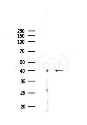 PDGFRL Antibody - Western blot analysis of lysates from B16F10-LUC cells(UV,30min treatment), using PDGFRL Antibody at 1/1000 dilution.