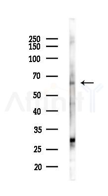 TRIP4 Antibody - Western blot analysis of lysates from PC12 cells(UV,30min treatment), using TRIP4 Antibody at 1/1000 dilution.