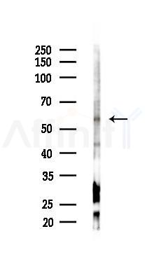Smad1/5/9 Antibody - Western blot analysis of lysates from HUVEC cells(starvation,24h treatment), using Smad1/5/9 Antibody at 1/1000 dilution.