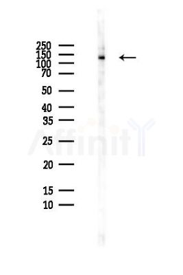 DGKD Antibody - Western blot analysis of lysates from HepG2 cells(heat-shock,45min treatment), using DGKD Antibody at 1/1000 dilution.