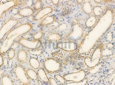 DOK7 Antibody - DF3308 at 1/100 staining human normal kidney tissue by IHC-P.