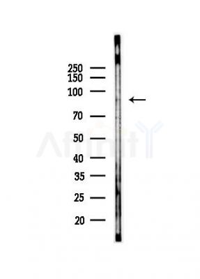 AAK1 Antibody - Western blot analysis of lysates from HUVEC cells(LPS, 4h treatment), using AAK1 Antibody at 1/1000 dilution.