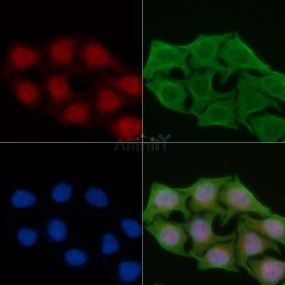 DAK Antibody - DF3310 staining Hela cells(45min of heat-shock) by IF/ICC.