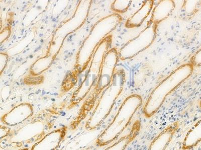 CERKL Antibody - DF3312 at 1/100 staining human normal kidney tissue by IHC-P.