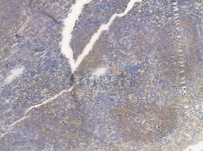 CERKL Antibody - DF3312 at 1/100 staining human normal tonsil tissue by IHC-P.