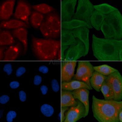 FAKD1 Antibody - DF3315 staining Hela cells by IF/ICC.