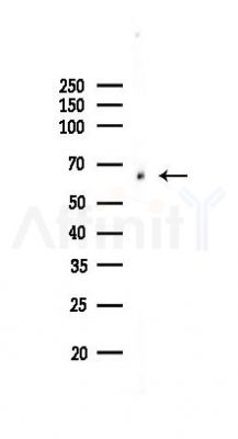 SGOL1 Antibody - Western blot analysis of lysates from Rat brain, using SGOL1 Antibody at 1/1000 dilution.