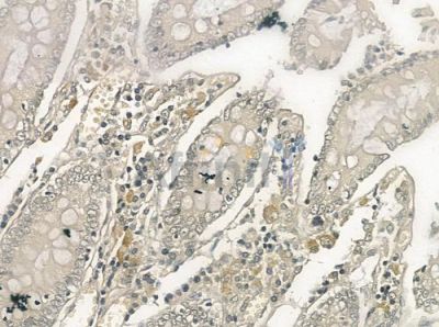 STEAP4 Antibody - DF3322 at 1/100 staining human normal colon tissue by IHC-P.