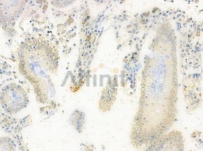 STRAD Antibody - DF3334 at 1/100 staining human normal colon tissue by IHC-P.
