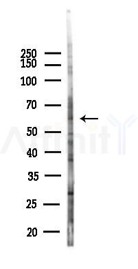 ADCK2 Antibody - Western blot analysis of lysates from Hela cells(heat-shock,45min treatment), using ADCK2 Antibody at 1/1000 dilution.