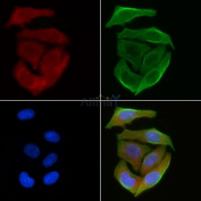 MAGI2 Antibody - DF3339 staining Hela cells(30min of UV treatment) by IF/ICC.