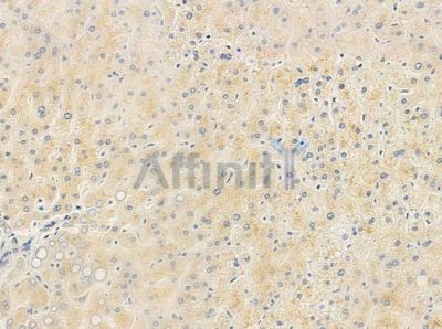 AKAP14 Antibody - DF3340 at 1/100 staining human normal liver tissue by IHC-P.