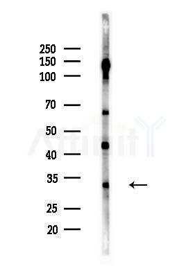 SIAH Antibody - Western blot analysis of lysates from LoVo cells(heat-shock,45min treatment), using SIAH Antibody at 1/1000 dilution.