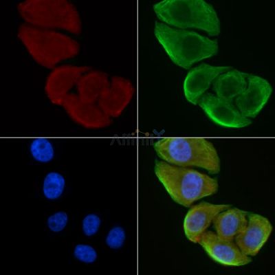 TBC1D3 Antibody - DF3346 staining Hela cells(30min of UV treatment) by IF/ICC.