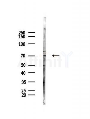 HIPK4 Antibody - Western blot analysis of lysates from HepG2 cells(heat-shock,45min treatment), using HIPK4 Antibody at 1/1000 dilution.