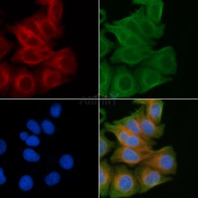 RGAG1 Antibody - DF3354 staining Hela cells(45min of heat-shock) by IF/ICC.
