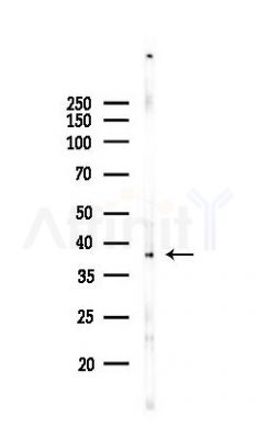 DOK4 Antibody - Western blot analysis of lysates from Mouse lung, using DOK4 Antibody at 1/1000 dilution.
