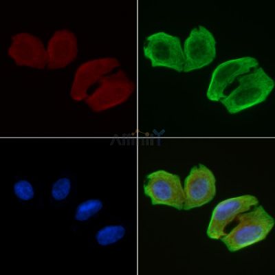 BRI3B Antibody - DF3376 staining Hela cells(30min of UV treatment) by IF/ICC.