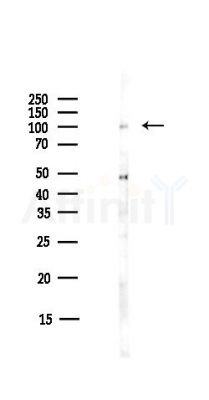 MKL1 Antibody - Western blot analysis of lysates from COLO205 cells(heat-shock,45min treatment), using MKL1 Antibody at 1/1000 dilution.