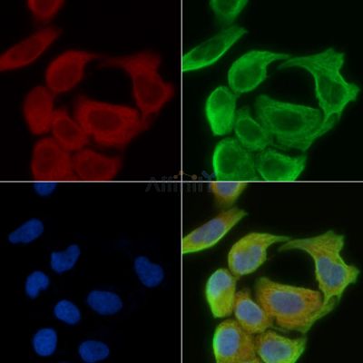 ADPGK Antibody - DF3414 staining Hela cells(30min of UV treatment) by IF/ICC.