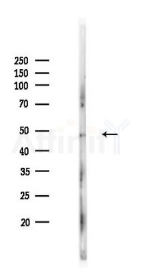 ADPGK Antibody - Western blot analysis of lysates from Rat liver, using ADPGK Antibody at 1/1000 dilution.
