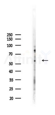 ADPGK Antibody - Western blot analysis of lysates from HepG2 cells(heat-shock,45min treatment), using ADPGK Antibody at 1/1000 dilution.