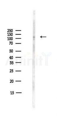 IFIH1 Antibody - Western blot analysis of lysates from COLO205 cells(heat-shock,45min treatment), using IFIH1 Antibody at 1/1000 dilution.
