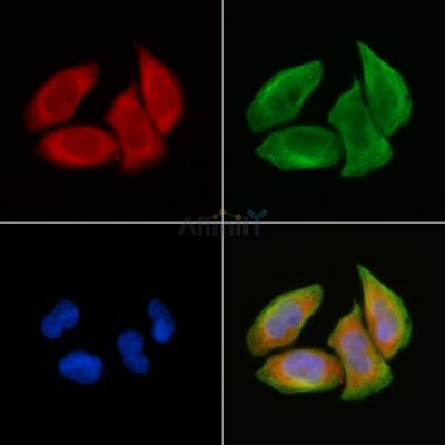 NT5C3 Antibody - DF3430 staining Hela cells(30min of UV treatment) by IF/ICC.