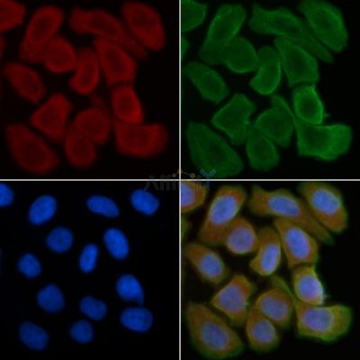 SEMA4A Antibody - DF3434 staining Hela cells(30min of UV treatment) by IF/ICC.