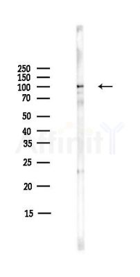 MARK1/2/3/4 Antibody - Western blot analysis of lysates from COLO205 cells(heat-shock,45min treatment), using MARK1/2/3/4 Antibody at 1/1000 dilution.
