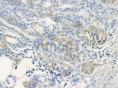 LW-1 Antibody - DF3460 at 1/100 staining human normal gastric tissue by IHC-P.