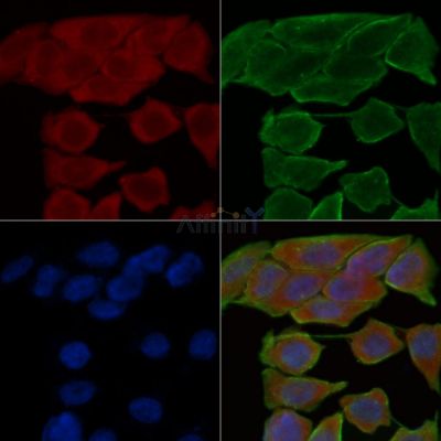 EPHA6 Antibody - DF3464 staining Hela cells(30min of UV treatment) by IF/ICC.