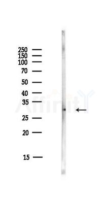 Mlx Antibody - Western blot analysis of lysates from HUVEC cells(starvation,24h treatment), using Mlx Antibody at 1/1000 dilution.
