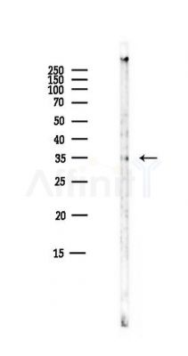 Mlx Antibody - Western blot analysis of lysates from Mouse liver, using Mlx Antibody at 1/1000 dilution.