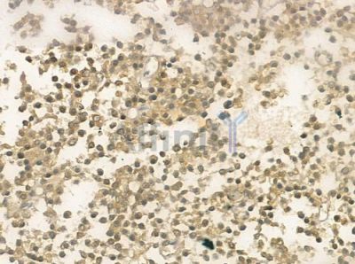 TRPS1 Antibody - DF3467 at 1/100 staining human pituitary adenoma by IHC-P.
