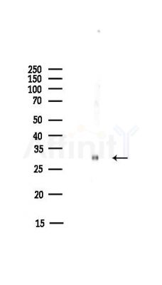 14-3-3 beta Antibody - Western blot analysis of lysates from COLO205 cells(heat-shock,45min treatment), using 14-3-3 beta Antibody at 1/1000 dilution.