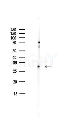 14-3-3 epsilon Antibody - Western blot analysis of lysates from COLO205 cells(heat-shock,45min treatment), using 14-3-3 epsilon Antibody at 1/1000 dilution.