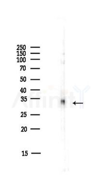 14-3-3 epsilon Antibody - Western blot analysis of lysates from HUVEC cells(starvation,24h treatment), using 14-3-3 epsilon Antibody at 1/1000 dilution.