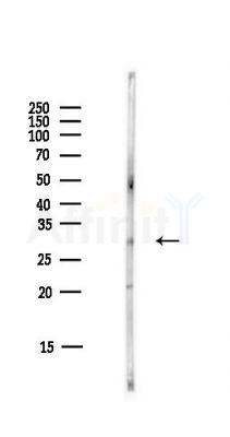 14-3-3 zeta/delta Antibody - Western blot analysis of lysates from HUVEC cells(starvation,24h treatment), using 14-3-3 zeta/delta Antibody at 1/1000 dilution.