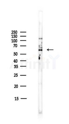 5HT2B Receptor Antibody - Western blot analysis of lysates from COLO205 cells(heat-shock,45min treatment), using 5HT2B Receptor Antibody at 1/1000 dilution.