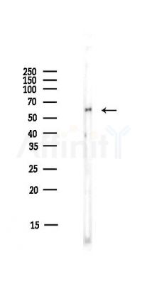 5HT2B Receptor Antibody - Western blot analysis of lysates from HUVEC cells(starvation,24h treatment), using 5HT2B Receptor Antibody at 1/1000 dilution.