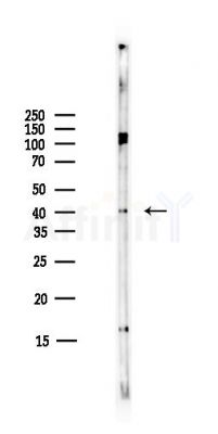 5-HT-4 Antibody - Western blot analysis of lysates from COLO205 cells(heat-shock,45min treatment), using 5-HT-4 Antibody at 1/1000 dilution.