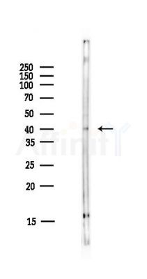 5-HT-4 Antibody - Western blot analysis of lysates from HUVEC cells(starvation,24h treatment), using 5-HT-4 Antibody at 1/1000 dilution.