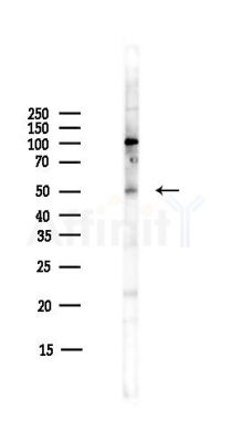 ADRB1 Antibody - Western blot analysis of lysates from COLO205 cells(heat-shock,45min treatment), using ADRB1 Antibody at 1/1000 dilution.