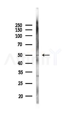 ARRB1 Antibody - Western blot analysis of lysates from Mouse lung, using ARRB1 Antibody at 1/1000 dilution.