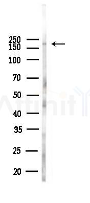 BCOR Antibody - Western blot analysis of lysates from 293 cells(heat-shock,45min treatment), using BCOR Antibody at 1/1000 dilution.