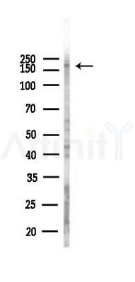 BCOR Antibody - Western blot analysis of lysates from Hela cells(heat-shock,45min treatment), using BCOR Antibody at 1/1000 dilution.