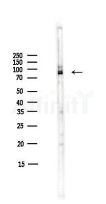 CDH3 Antibody - Western blot analysis of lysates from COLO205 cells(heat-shock,45min treatment), using CDH3 Antibody at 1/1000 dilution.